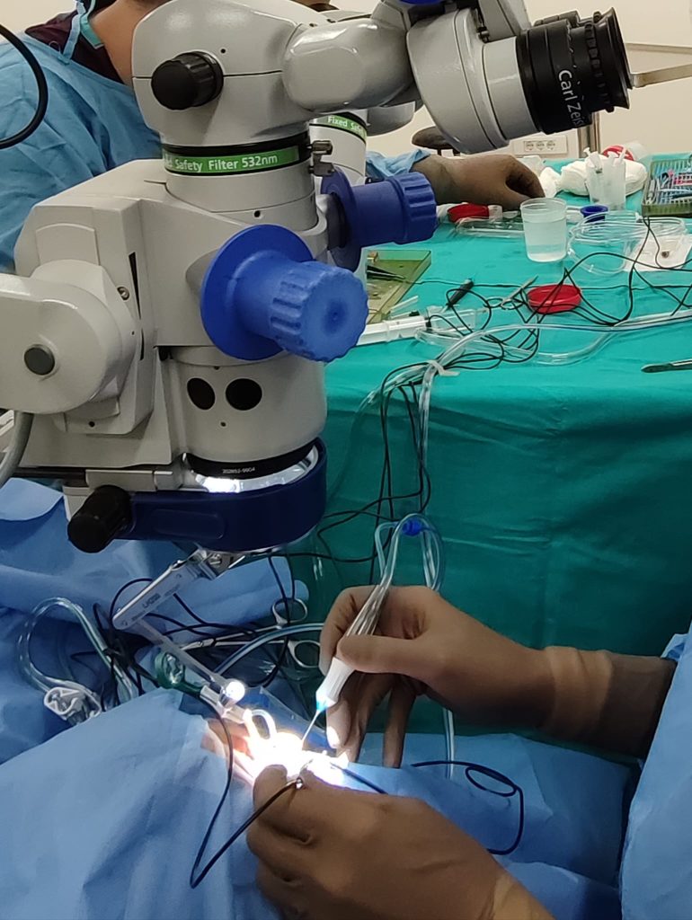 Hangi Göz Hastalıklarında Vitrektomi Cerrahi Uygulanır